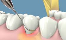 periodoncia
